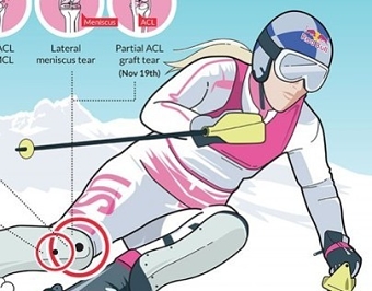 Red Bull: Lindsey Vonn Recovery INFOGRAPHIC