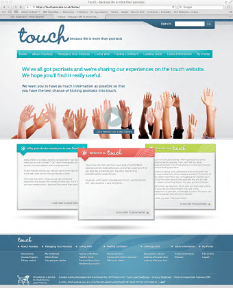 Touch - because life is more than psoriasis