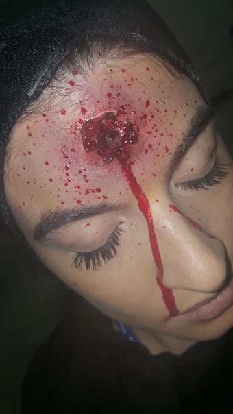 Casualty