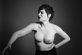 Pink October – Bigger Than a Scar