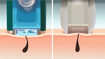 3D product animation - Epilator3D product animation - Epilator
