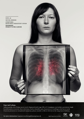 Lung Cancer, See Through The Symptoms