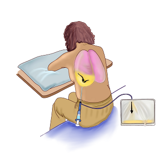 Medical illustration