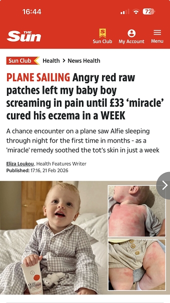 Miracle eczema cure EXCLUSIVE health story